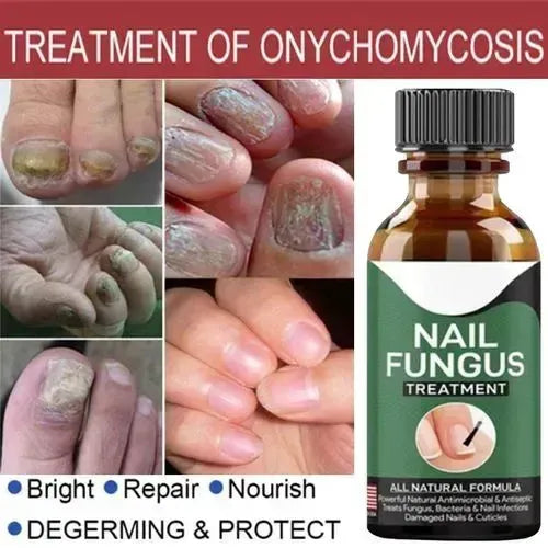 Nail Care Treatment Serum – Nail Repair & Care Essence